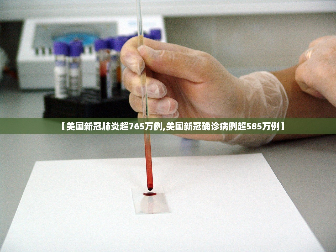 【美国新冠肺炎超765万例,美国新冠确诊病例超585万例】 【美国新冠肺炎超765万例,美国新冠确诊病例超585万例】