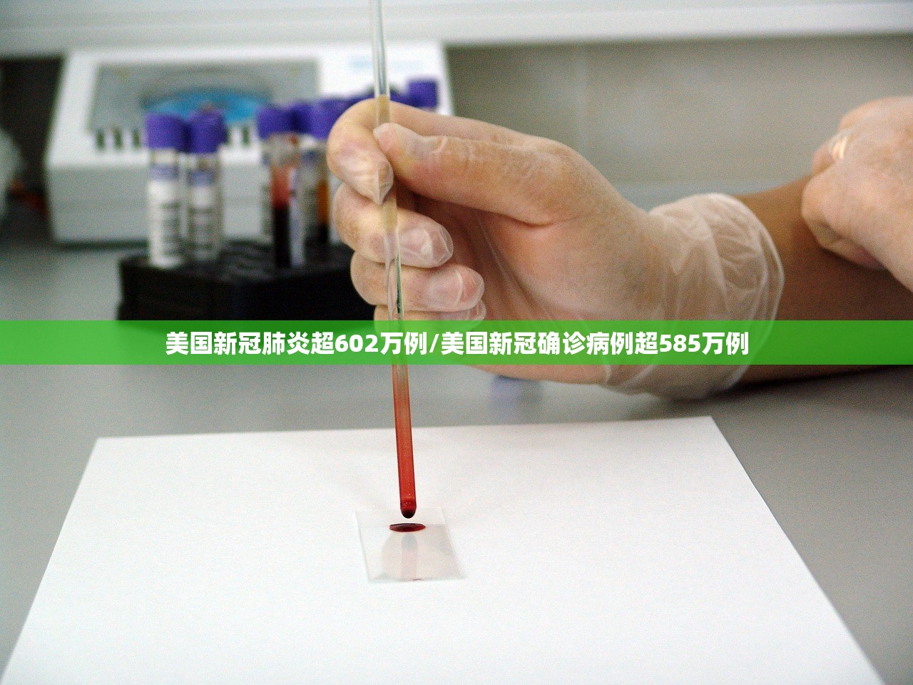 美国新冠肺炎超602万例/美国新冠确诊病例超585万例 美国新冠肺炎超602万例/美国新冠确诊病例超585万例